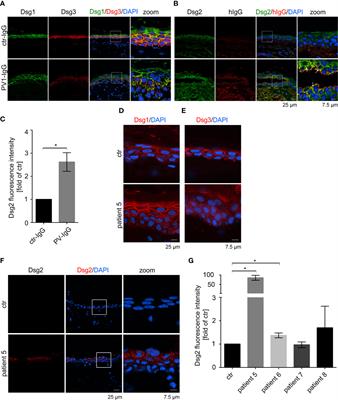 Dsg2 Upregulation as a Rescue Mechanism in Pemphigus